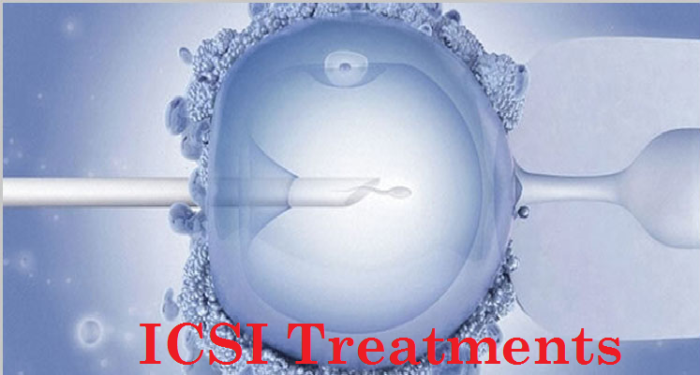 ICSI treatment